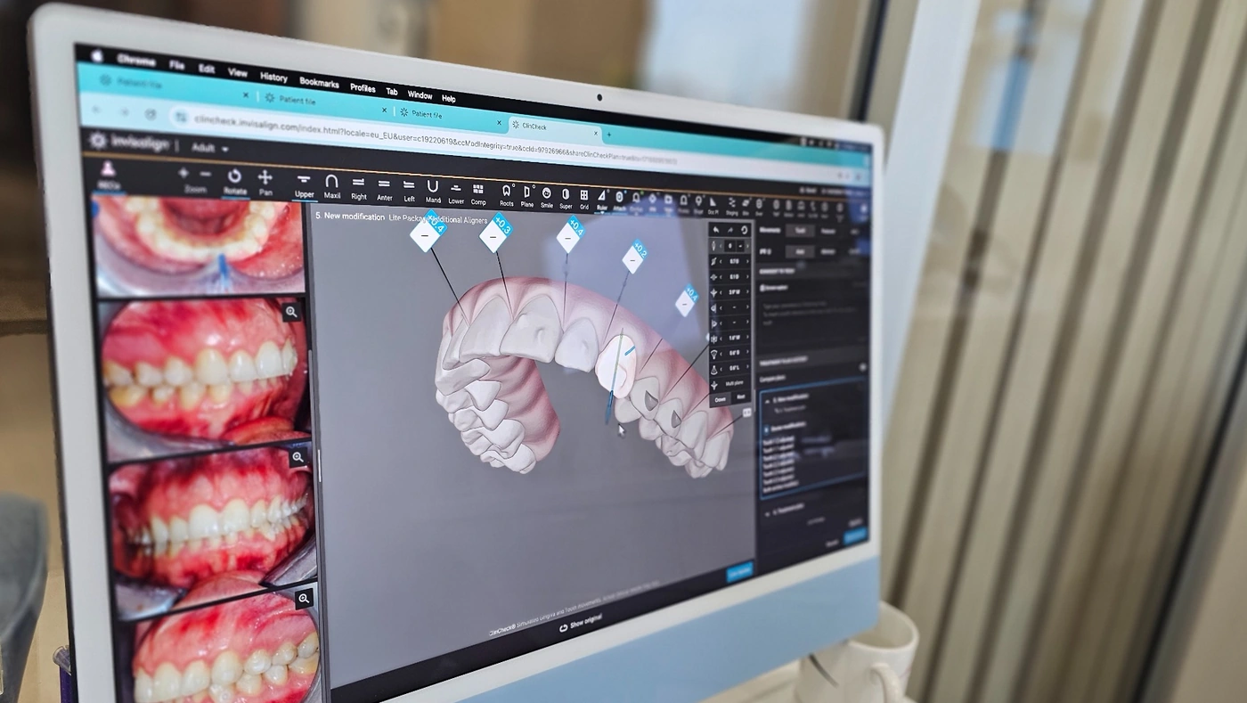 Digital dental treatment planning